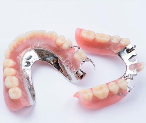 Two partial dentures with metal attachments