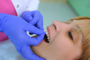 Close up of dentist carefully placing dental veneers