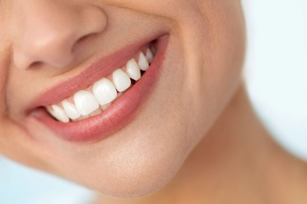 A closeup of a beautiful smile.